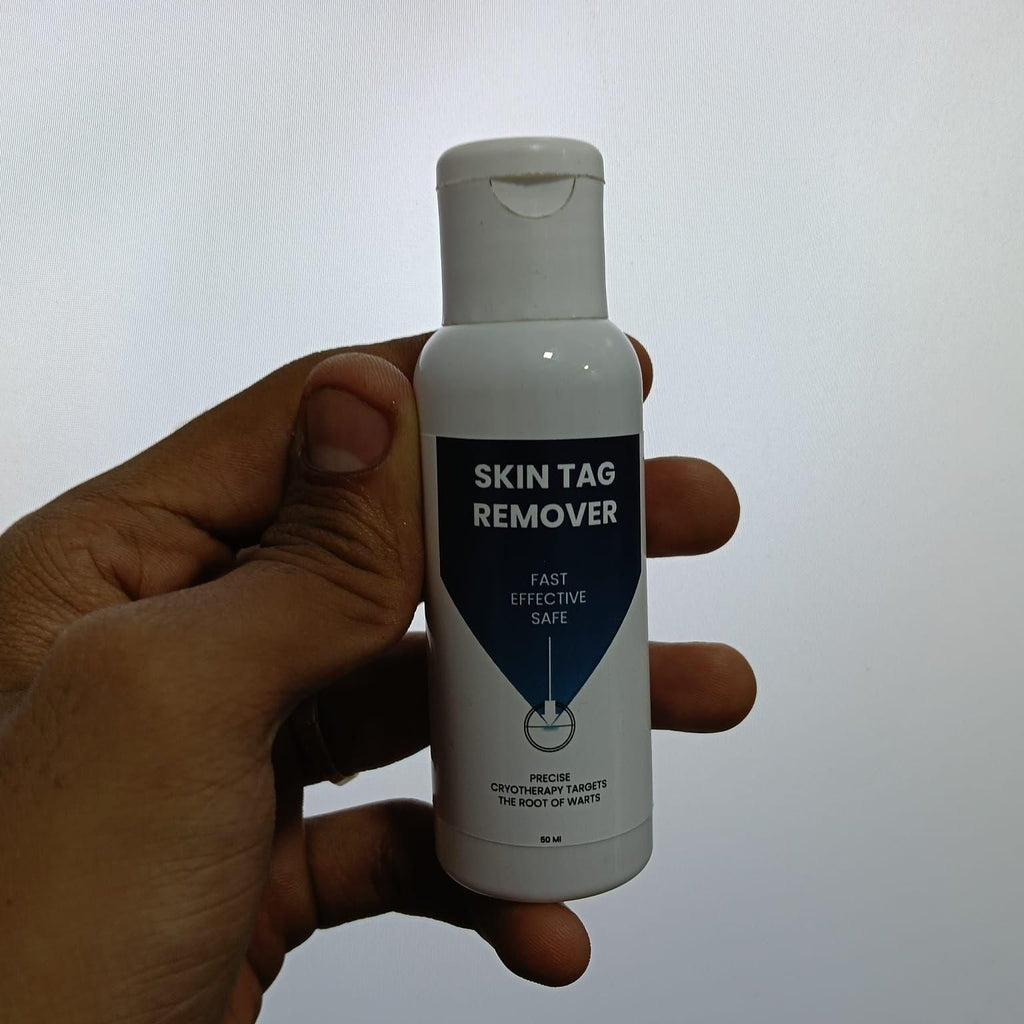 Skin Tag Remover 50 ml Pack of 1