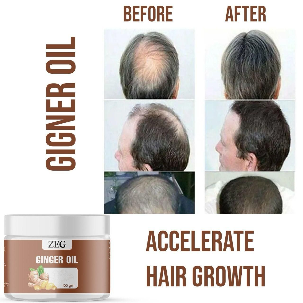 ZEG GINGER OIL 100GM (Pack of 2)