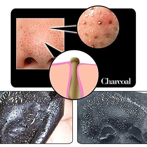 Deep Cleansing Blackhead Remover Strips (Pack of 10)