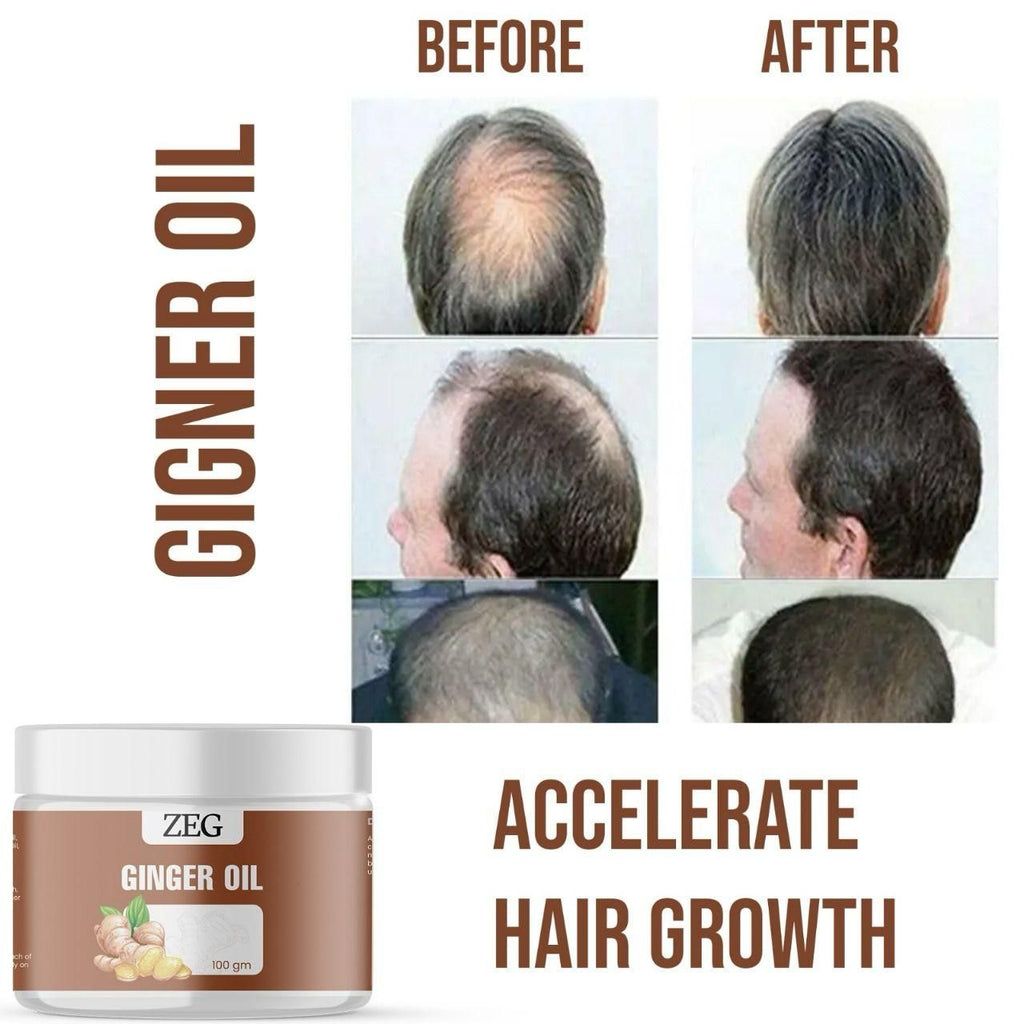 ZEG GINGER OIL 100GM ? 100% Natural Multipurpose Oil for Hair, Skin & Body
