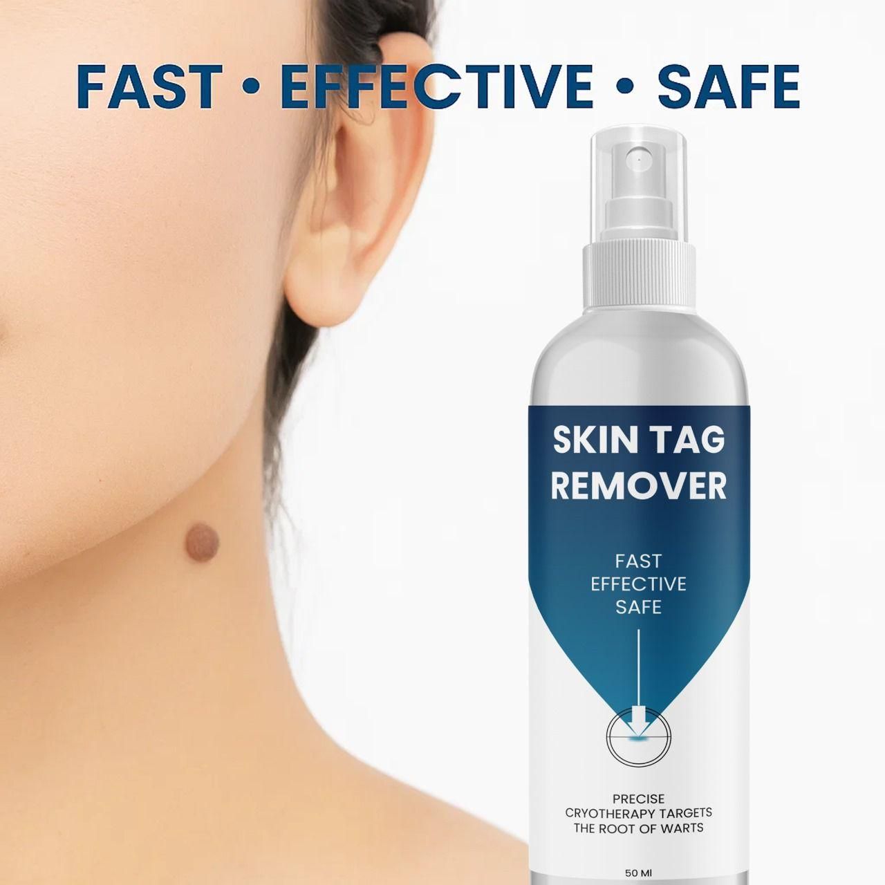 Skin Tag Remover 50 ml Pack of 1