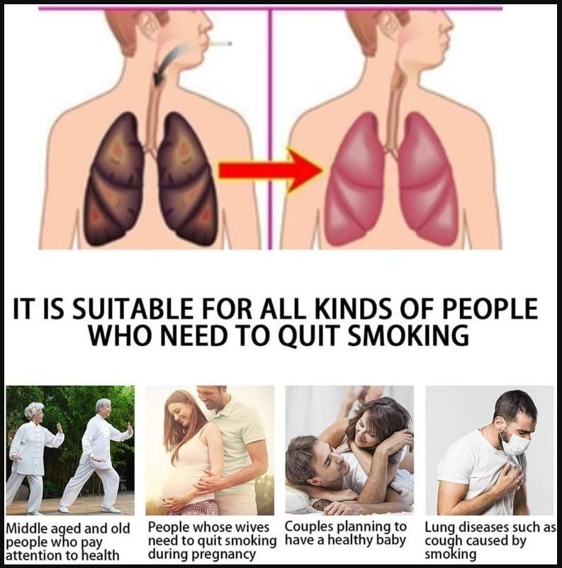 10 Pcs Anti-Smoking Patches