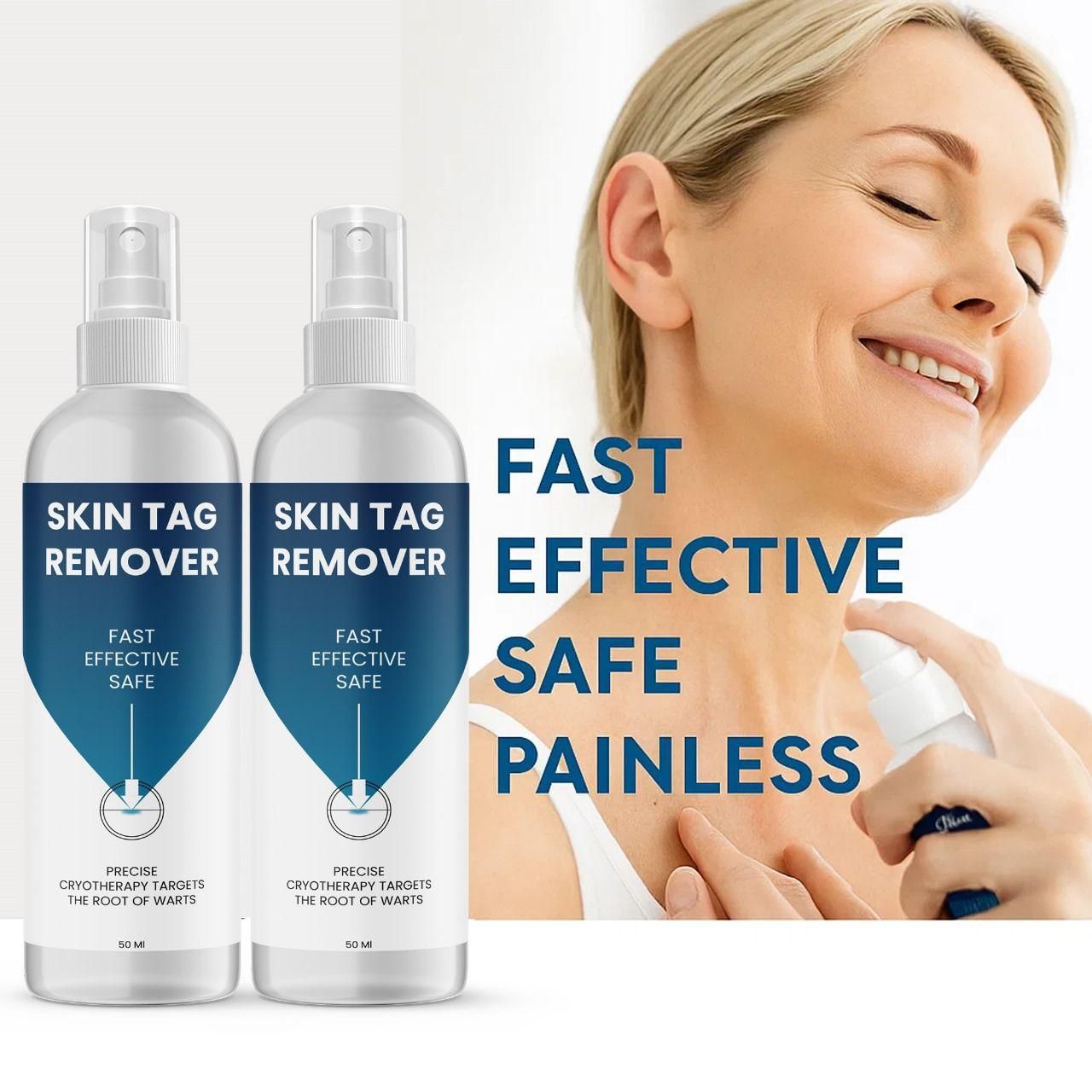 Skin Tag Remover 50 ml Pack of 1