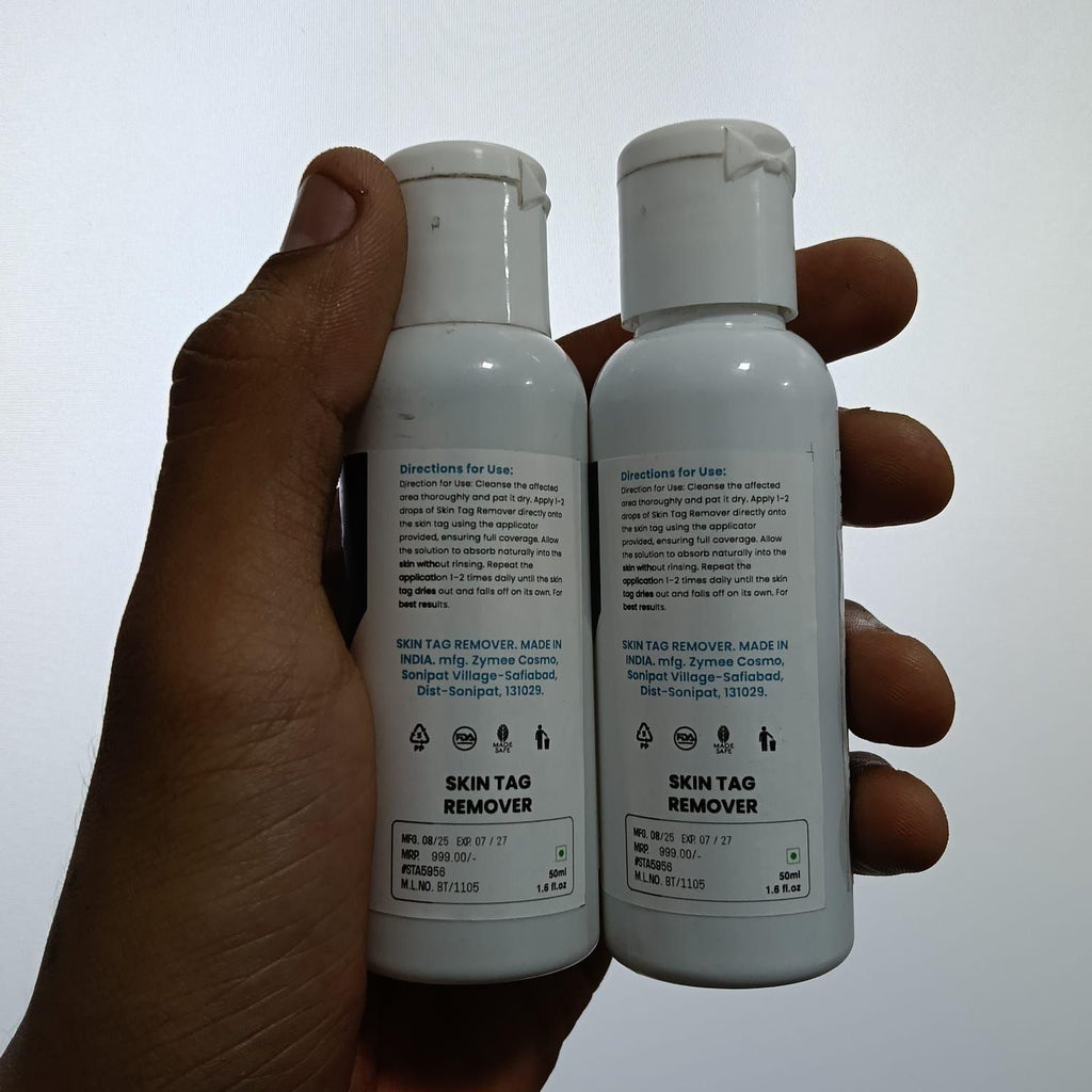 Skin Tag Remover 50 ml Pack of 1